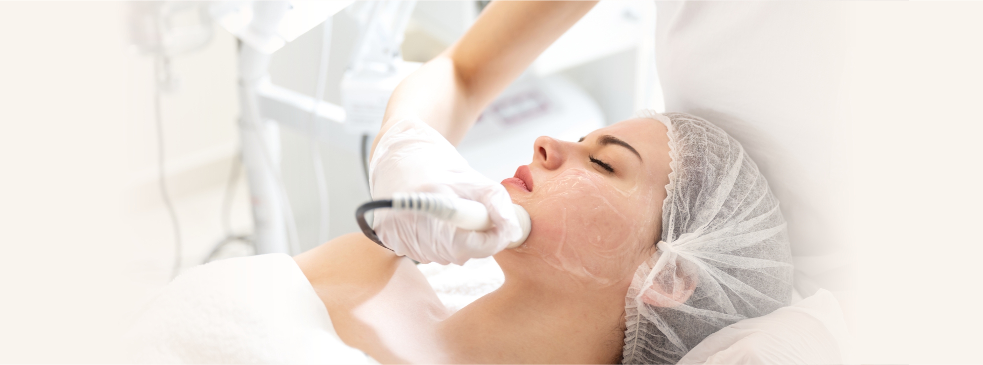 Microneedling Radiofrequency MNRF For Acne Scars Medicare