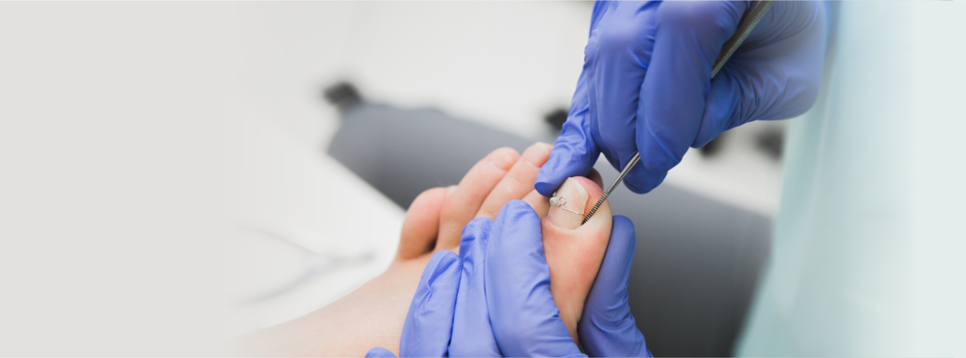 Ingrown Toe Nail Surgery Medicare